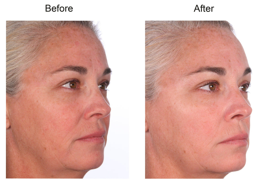 5 Warning Signs Your Body Needs More Collagen (Don't Igore #3)