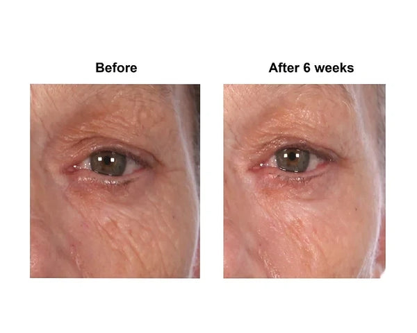 Crepey Skin Eye FX - 1 oz (30 ml) | Kellie Olver Products - Best Under-eye Treatment For Crepey Skin