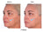 Collagen powder before and after pictures face 