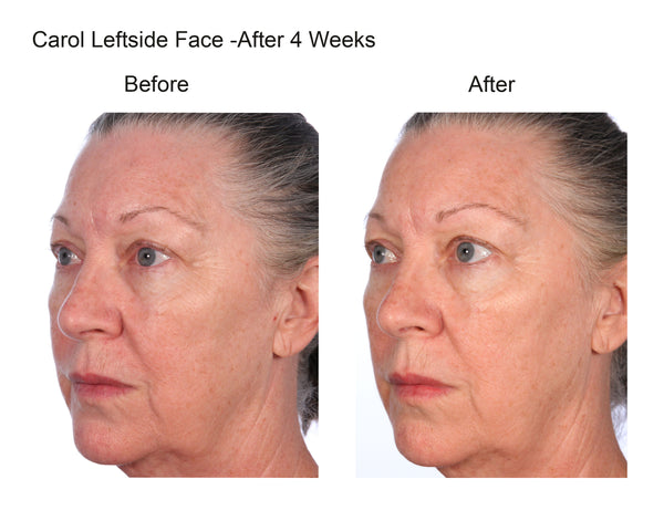 Triple K Collagen 15 Serving Bag