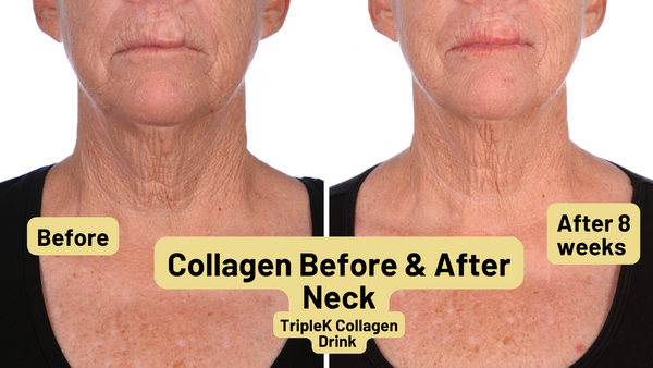 Triple K Collagen Supplement, 30 Servings | Triple K Collagen