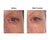 crepey skin pictures  under eye before and after