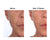 crepey skin on face before and after pictures, crepey skin face, crepey skin before and after, pictures of crepey skin, crepey sin pictures