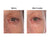 crepey skin pictures eye, glycolic acid before and after 